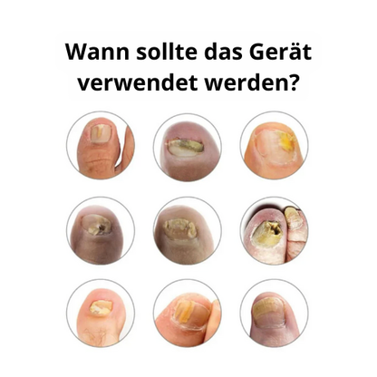 NAILUX™